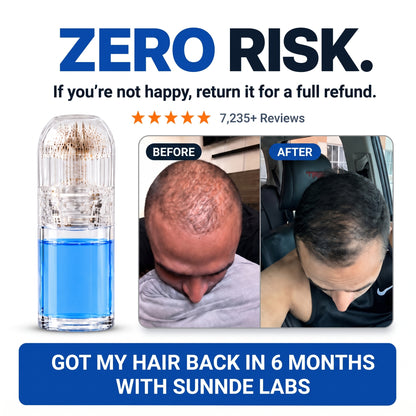 Sunnde Labs PepStack+™ Infusion Kit For Hair Regrowth