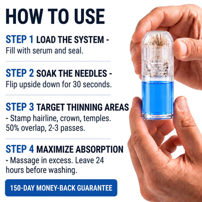 Sunnde Labs PepStack+™ Infusion Kit For Hair Regrowth